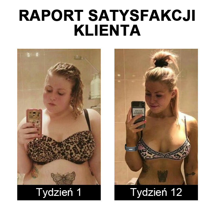 🎁 Ultragarsiniai diržai riebalų deginimui ir detoksikacijai-LT