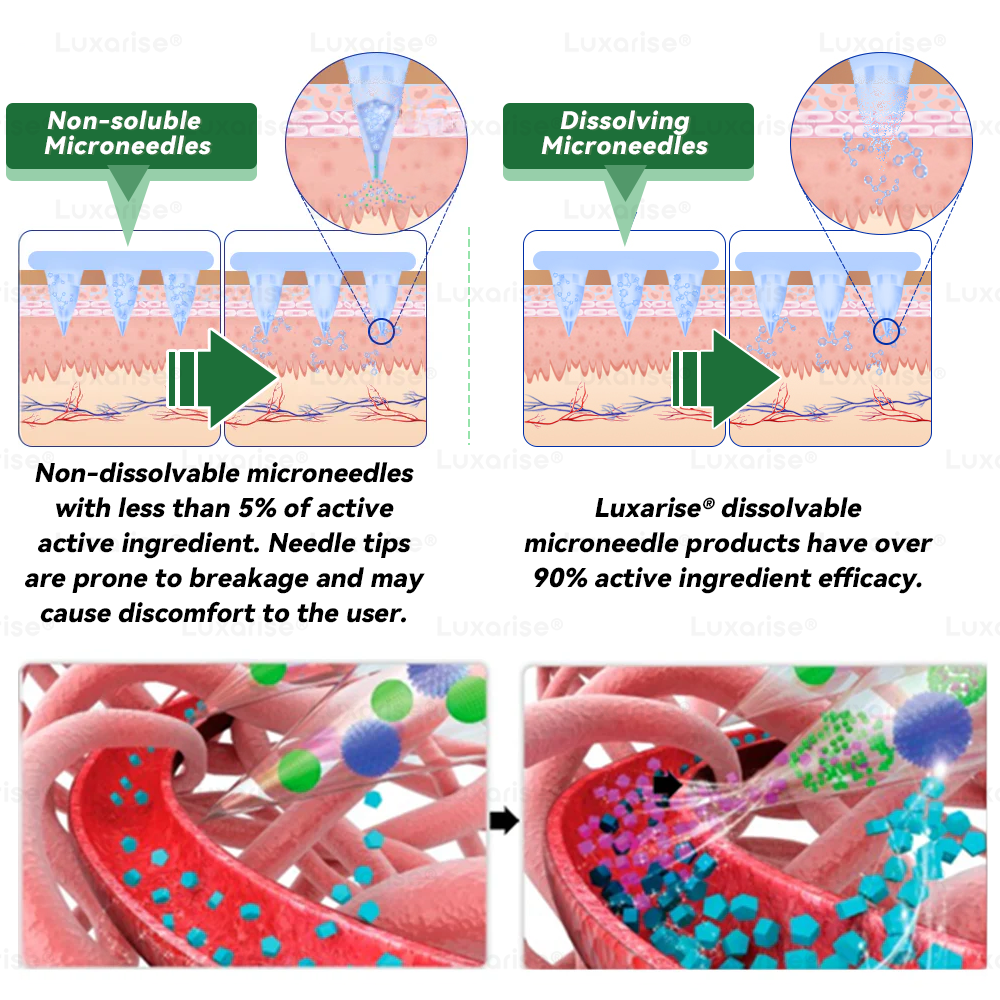 Uradna trgovina | Luxarise® Moringa & Berberine 10 v 1 napredni obliž z nanomikroiglami 📦 (enkrat na dan, vidne spremembe po 7 dneh) Težave s sklepi Debelost, sladkorna bolezen, apneja v spanju in-SI