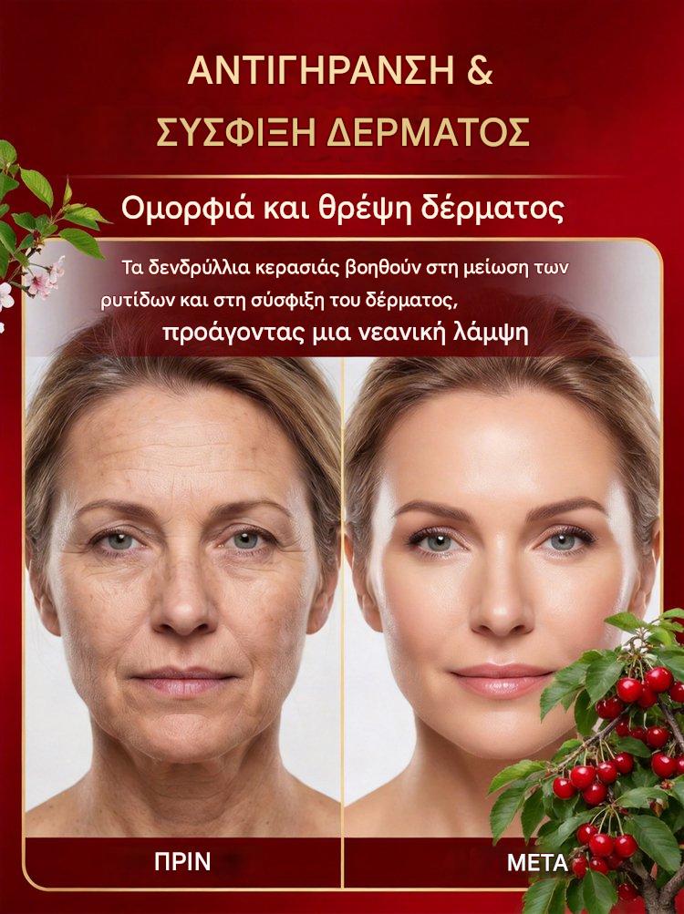 【Σύντομα】Νάνοι δενδρύλλια κερασιάς-GR