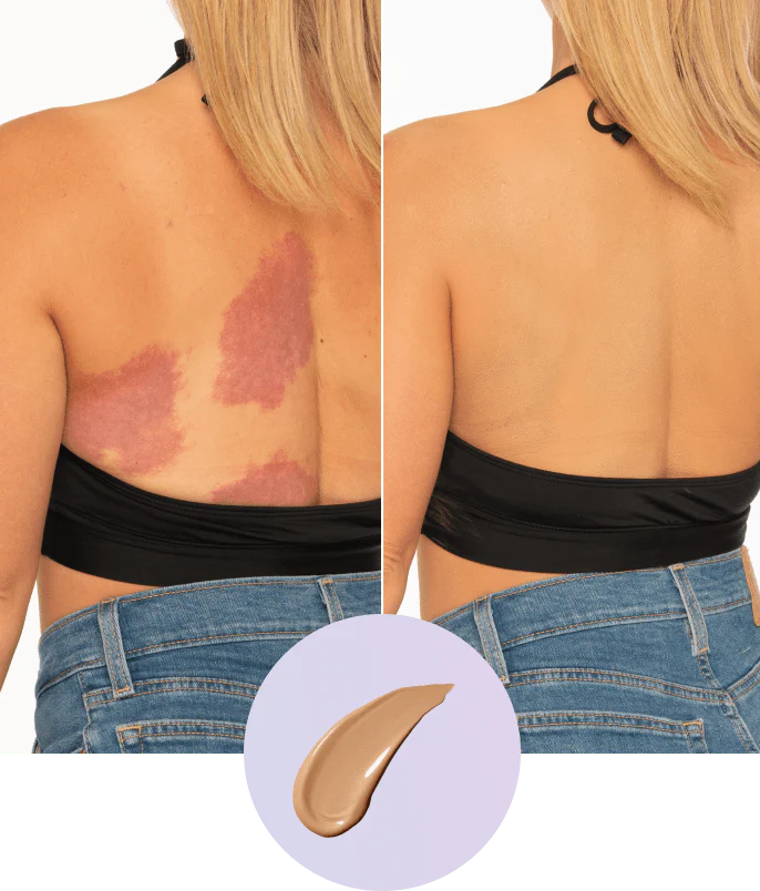 💜Τελευταία μέρα – αγοράστε 1, πάρτε 1 δωρεάν!💜✨Body Perfector – αδιάβροχο, ελαφρύ και άψογο μακιγιάζ σώματος-GR