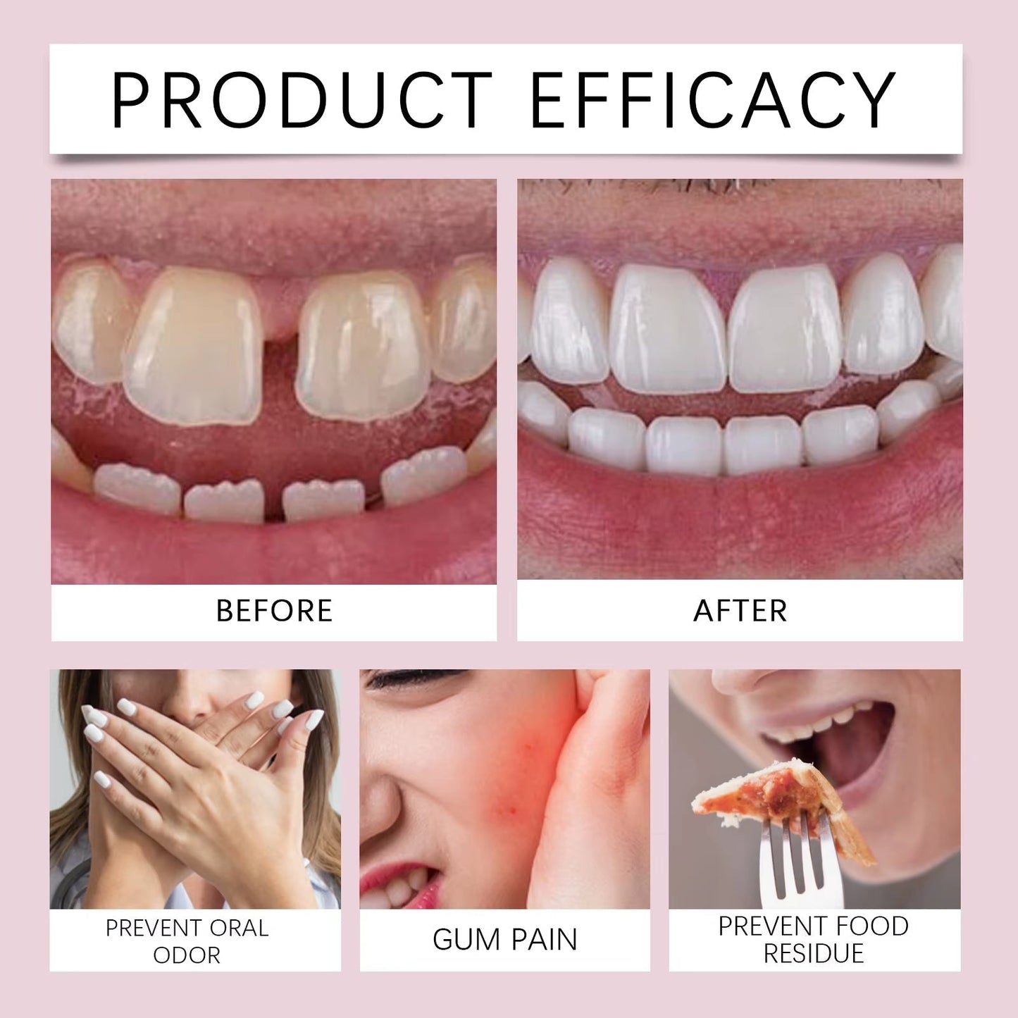 Τέλος στις χαλαρές οδοντοστοιχίες! Η πιο δημοφιλής στην Ευρώπη κόλλα για οδοντοστοιχίες μακράς διαρκείας.🔥-GR