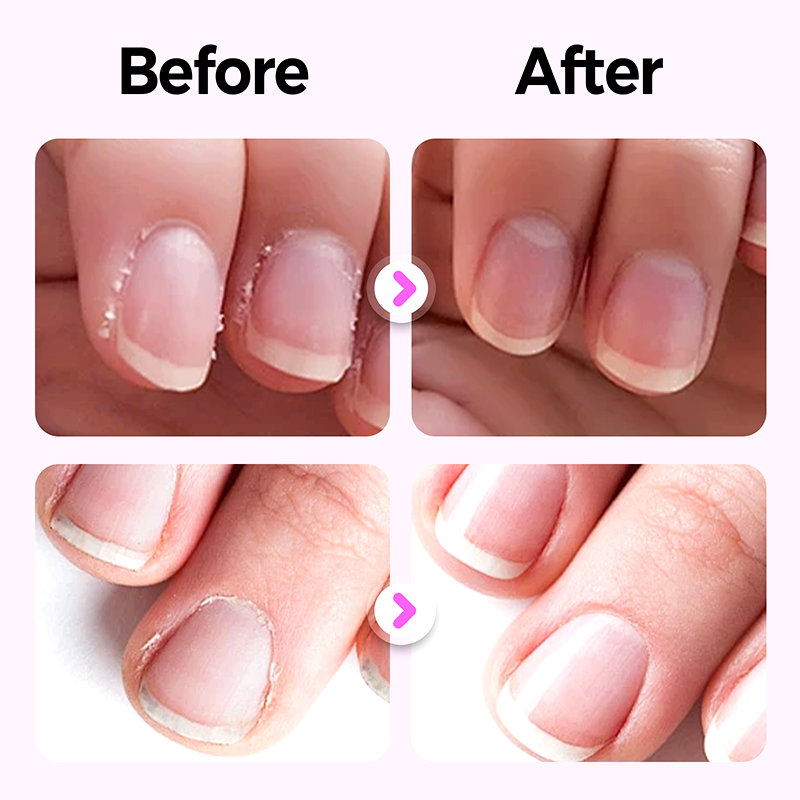 💜Kupite 1, dobite 1 gratis💜2025 Novo in izboljšano pisalo za nohte 3 v 1💅-SI