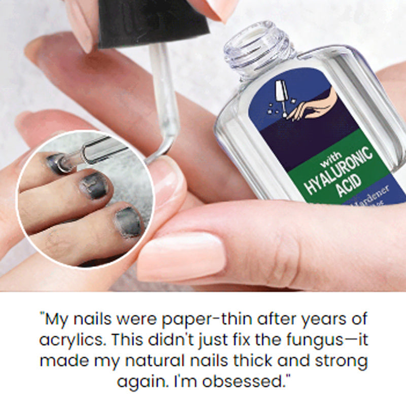 Μια απαλή και αποτελεσματική λύση για την αποκατάσταση των φυσικών νυχιών-GR